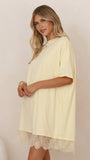 Saya T Shirt Lace Mini Dress Yellow